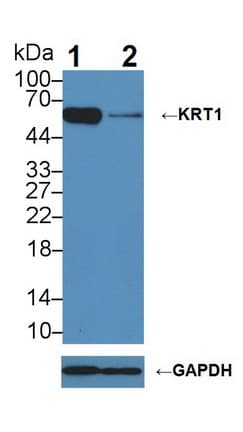 Polyclonal Rabbit anti-Human KRT1 / CK1 / Cytokeratin 1 Antibody (aa487-644, WB)