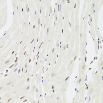 Polyclonal Rabbit anti-Human XRCC6 / Ku70 Antibody (IHC, IF, WB)