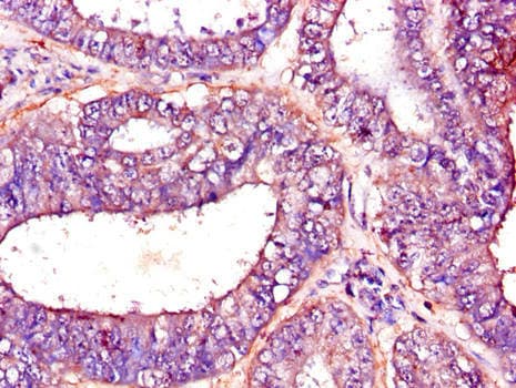 PFKM / PFK-1 Antibody