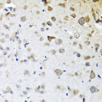 CPA6 / Carboxypeptidase A6 Antibody