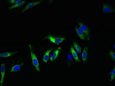Polyclonal Rabbit anti-Human KCND1 / Kv4.1 Antibody (IHC, WB)