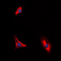 Polyclonal Rabbit anti-Human IL10RA Antibody (C-Terminus, IF, WB)