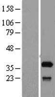 SFXN1 Protein (Over-Expression Lysate Myc-DDK (Flag))