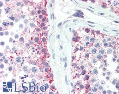 IHC-plus™ SLC35A2 / UGT Antibody
