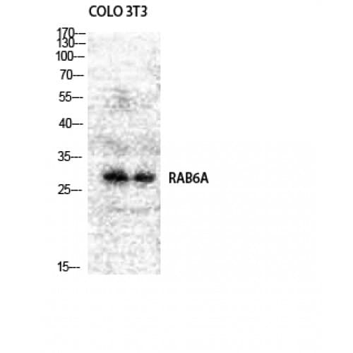Polyclonal Rabbit anti-Human RAB6A / RAB6 Antibody (90-170 aa, Internal, IHC, WB)