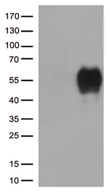 HAVCR2 / TIM-3 Antibody (clone OTI6E5)
