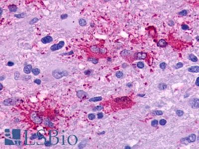 PathPlus™ C5AR2 / GPR77 / C5L2 Antibody (Extracellular Domain)