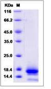Human CO-029 / TSPAN8 Protein (Recombinant His, N-Terminal)