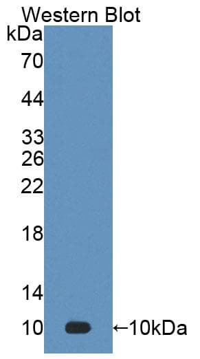 S100A7 / Psoriasin Antibody (aa1-101)
