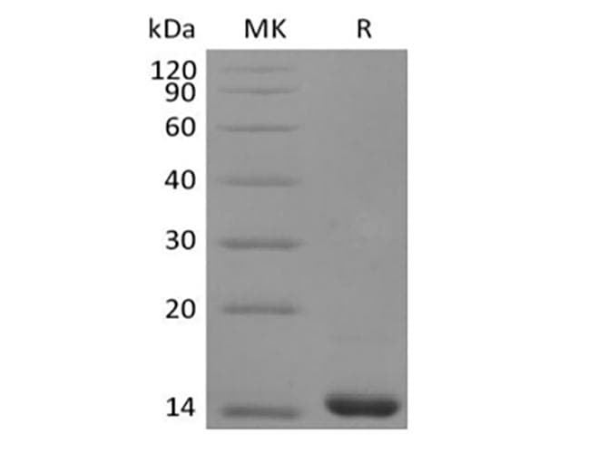 Human FGF4 Protein (Recombinant)