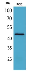 CD121b / IL1R2 Antibody
