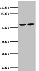 MUTYH / MYH Antibody (aa1-265)