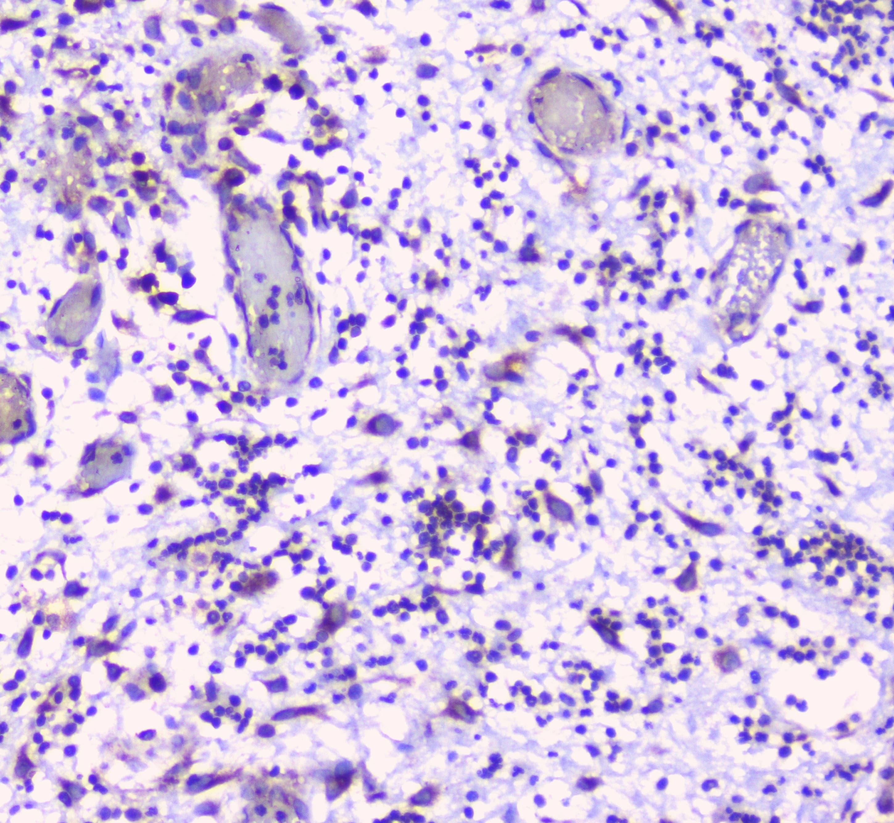 ERGIC-53 / LMAN1 Antibody