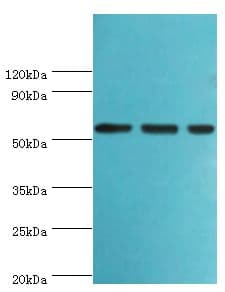 Polyclonal Rabbit anti-Human AAAS / Adracalin Antibody (aa287-546, IHC, WB)