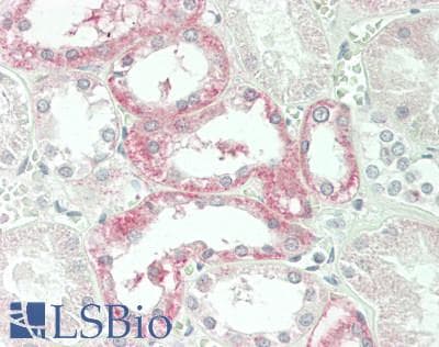 IHC-plus™ Polyclonal Rabbit anti-Human CPM / Carboxypeptidase M Antibody (aa212-241, IHC, WB)