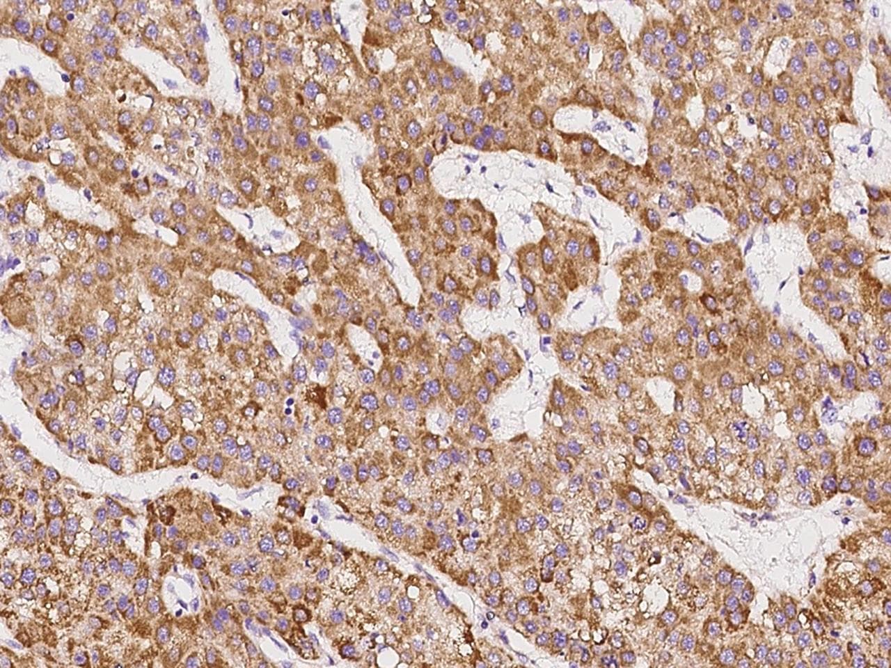 SCCPDH Antibody