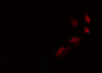 TLK2 Antibody
