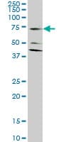SLC1A2 / EAAT2 / GLT-1 Antibody (clone 1D8)