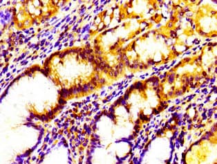 Polyclonal Rabbit anti-Human IL17D Antibody (IHC)