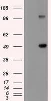 Monoclonal Mouse anti-Human GFAP Antibody (clone OTI4G8, IHC, IF, WB)