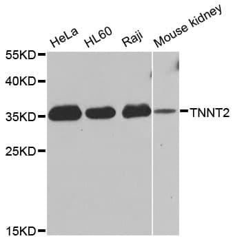 TNNT2 / CTNT Antibody
