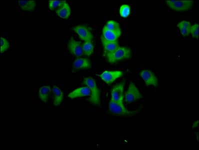ADGRG1 / GPR56 Antibody