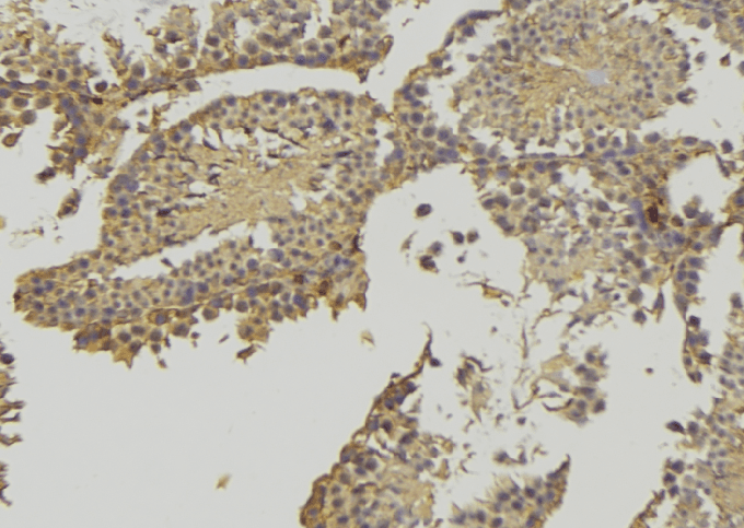 HSD3B2 Antibody