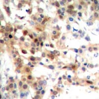 Polyclonal Rabbit anti-Human MAPK14 / p38 Antibody (Internal, IHC, WB)