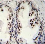 DDX27 Antibody (aa770-796)