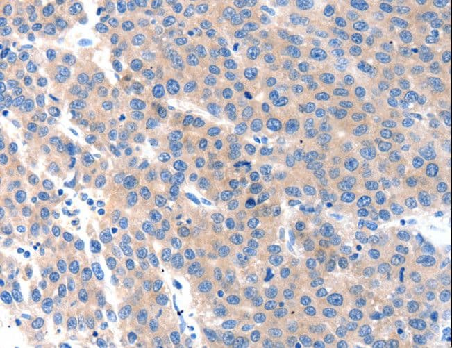 KLK2 / Kallikrein 2 Antibody