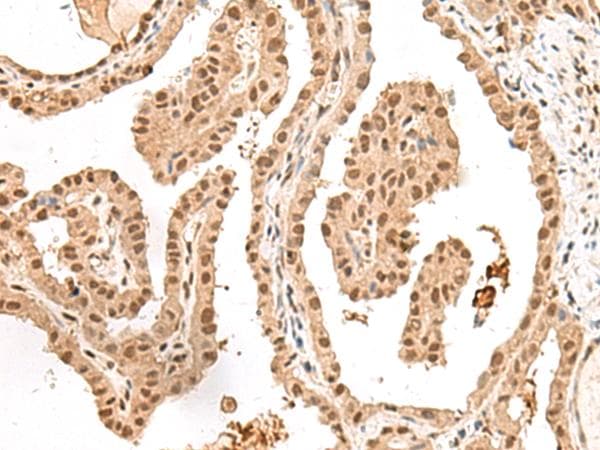 GAL4 / Galectin 4 Antibody