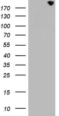 Monoclonal Mouse anti-Human CD68 Antibody (clone OTI1E6, aa22-319, WB)