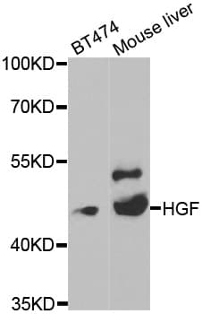 HGF / Hepatocyte Growth Factor Antibody
