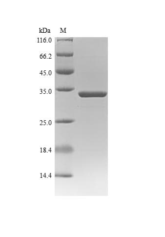 Sudan Ebolavirus Nucleocapsid Protein (Recombinant 6His, N-terminus)