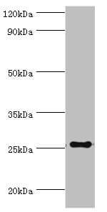 Polyclonal Rabbit anti-Human TFPI2 Antibody (aa23-235, IHC, WB)
