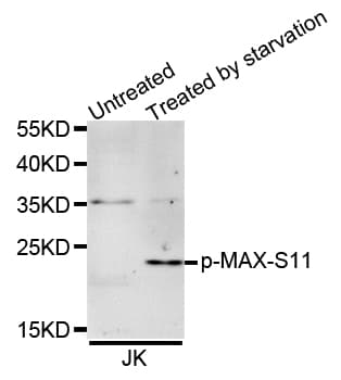 MAX Antibody (phospho-Ser11)