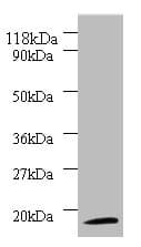 Polyclonal Rabbit anti-Human RPS11 / Ribosomal Protein 11 Antibody (IHC, WB)