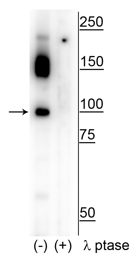 Polyclonal Rabbit anti-Human RBBP8 / CTIP Antibody (phospho-Ser326, WB)