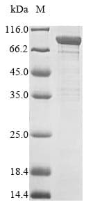 Human APH / APEH Protein (Recombinant 6His, N-terminus)