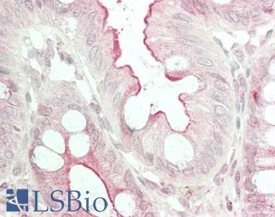 IHC-plus™ MGP / Matrix Gla-Protein Antibody