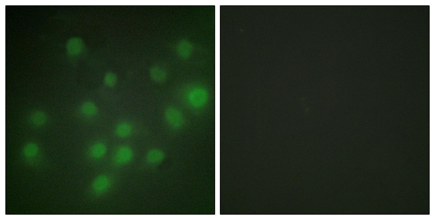 HKR1 Antibody