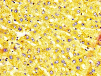 Polyclonal Rabbit anti-Human MST1 Antibody (IHC)
