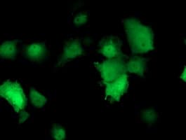 TMOD1 / Tropomodulin 1 Antibody (clone OTI3B12)