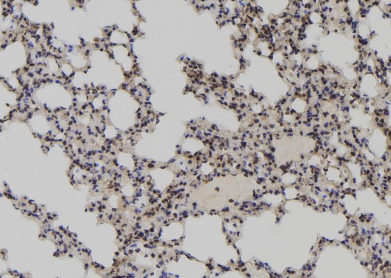 LARP7 Antibody