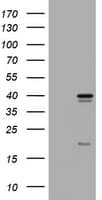Monoclonal Mouse anti-Human TS / Thymidylate Synthase Antibody (clone OTI1C5, WB)