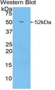NR3C1/Glucocorticoid Receptor Antibody (aa564-733)