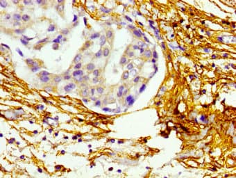 Polyclonal Rabbit anti-Human BMP10 Antibody (IHC)
