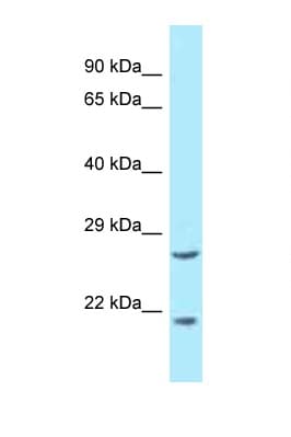 EEF1E1 / AIMP3 Antibody (aa30-79)
