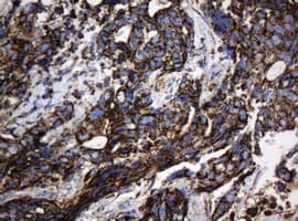 PathPlus™ HSPD1 / HSP60 Antibody (clone OTI3A2)
