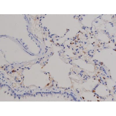 STAT6 Antibody (phospho-Tyr641)